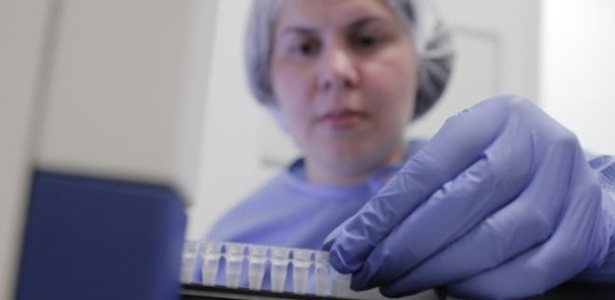 Novo exame pode aumentar diagnósticos de microcefalia ligada ao zika, diz diretor do Fiocruz