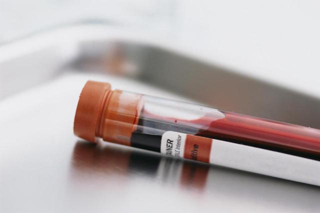 Japão desenvolve exame de sangue para detectar 13 tipos de câncer